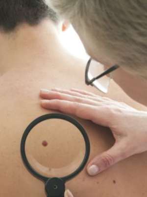 'Combo' de drogas em teste reduz tumores agressivos em 60%