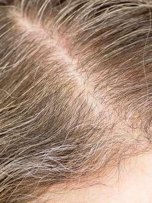 Mitos e verdades sobre os cabelos brancos