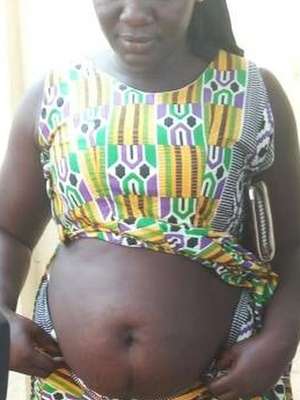 Curandeira é presa por inchar barrigas para convencer ...