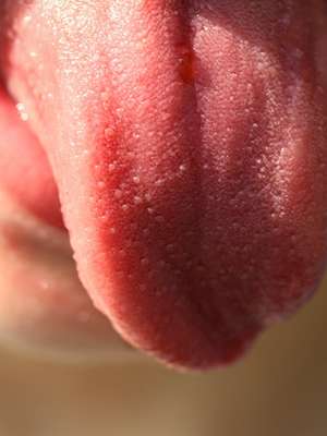 Dossiê Língua: cuidados e limpeza