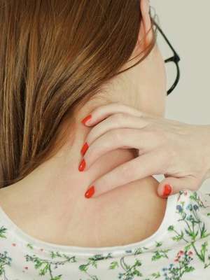 Onze fatos sobre coceira que você talvez não saiba