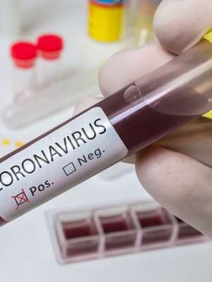 Vale compra 5 milhões de testes de coronavírus para o Brasil