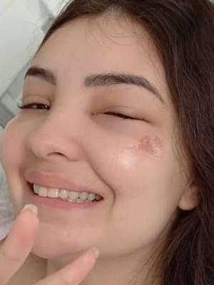 Com doença rara, Mabel Calzolari passa por sétima cirurgia