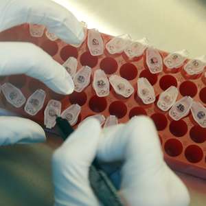 Rússia conclui testes clínicos de vacina para covid-19