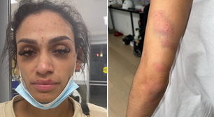 Esposa mostra ferimentos causados por agressão de astro da NBA