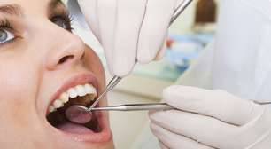 Carillas Dentales: para Mejorar la Apariencia de sus Dientes