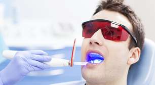 El láser promete sustituir las obturaciones dentales