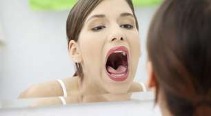 3 enfermedades que no sabías que tu lengua podía sufrir