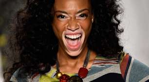 Modelo com vitiligo é destaque em passarela de Nova York