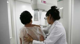 Novo exame pode prever risco de câncer de mama 5 anos antes