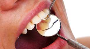 Cuidar da gengiva é muito mais importante do que você pensa