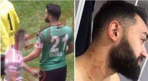 Jogador turco acusado de ferir adversários com uma lâmina é banido do futebol