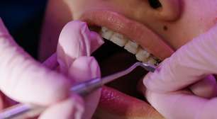 Como se tratavam os dentes antes dos dentistas?