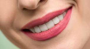 Clareamento dental: mitos e verdades sobre o procedimento