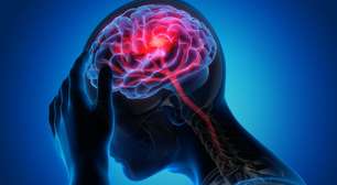 Epilepsia: mitos e verdades sobre a condição neurológica