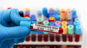 COVID-19 aumenta risco de trombose e embolia pulmonar