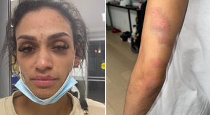 Esposa mostra ferimentos causados por agressão de astro da NBA