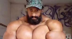 'Hulk brasileiro' injetava óleo mineral para ficar com músculos enormes; entenda