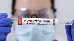 Já é o momento de se preocupar com a varíola dos macacos? Especialistas respondem