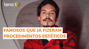 De botox a implante capilar: Veja quais famosos passaram por procedimentos estéticos