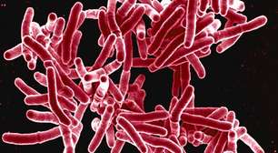 Cientistas descobrem 20 genes que tornam a tuberculose resistente a antibióticos