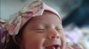 Bebê nasce com dois dentes. Entenda o fenômeno raro