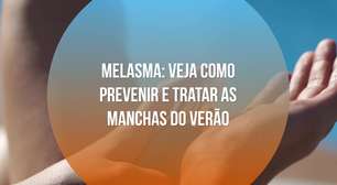 Melasma: veja como prevenir e tratar as manchas do verão