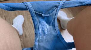 Corrimento vaginal: branco, amarelo, marrom, com cheiro