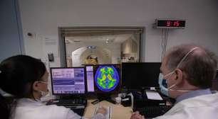 Pesquisadores de Los Angeles identificaram quatro caminhos mais comuns para o Alzheimer