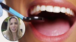 Vídeo: 5 perigos de se fazer um clareamento dental caseiro