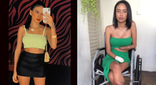 Jovem que perdeu braços e pernas após grave infecção urinária ganha vaquinha para conseguir próteses