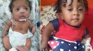 Bebê com ossos de vidro, que não pode nem ser carregada pela mãe, precisa de cadeira adaptada