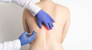 Ozonioterapia, reiki, acupuntura: a polêmica dos tratamentos alternativos