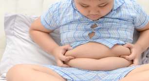Obesidade infantil: entenda quais as causas e como combater o problema