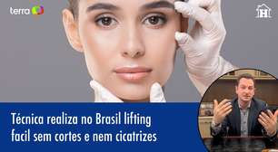Lifting facial sem cortes ou cicatrizes já é realizado no Brasil