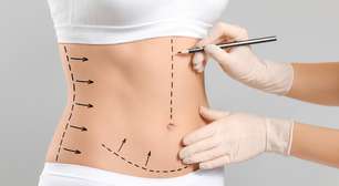 Lipo com jato de plasma: entenda a técnica que trata flacidez