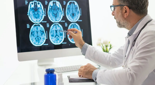 Quanto ganha um neurocirurgião? Média salarial atual