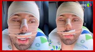 Rico Melquíades explica que fez cirurgia no rosto por 'não aguentar mais ser chamado de feio'