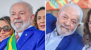 Veja antes e depois de Lula após cirurgia plástica