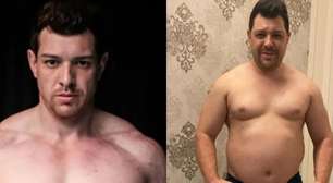 Ex-BBB ganha 40 kg e encontra tumor na nuca após compulsão