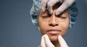 Em desuso, harmonização facial é substituída por novas técnicas