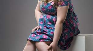 Lipedema: como tratar o excesso de gordura localizada nas pernas
