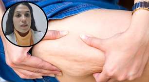 Vídeo: Como combater de vez a celulite em 5 passos simples