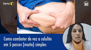 Como combater de vez a celulite em 5 passos simples