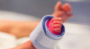 Os cuidados com os bebês prematuros. Veja o que fazer