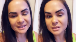 Mulher fica com o olho travado após aplicação de botox com esteticista