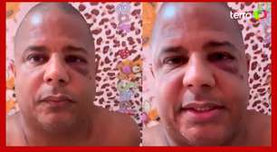 Marcelinho diz que foi sequestrado por sair com mulher casada; 'Forçado a falar', diz advogado