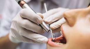 Mulher processa dentista por receber oito coroas, fazer quatro canais e 20 obturações numa única sessão