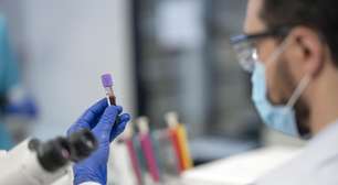 Febre suína gera decreto de emergência no Piauí; entenda o que acontece agora