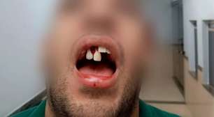 Goiânia: morador de condomínio agride e quebra dentes de entregador de aplicativo